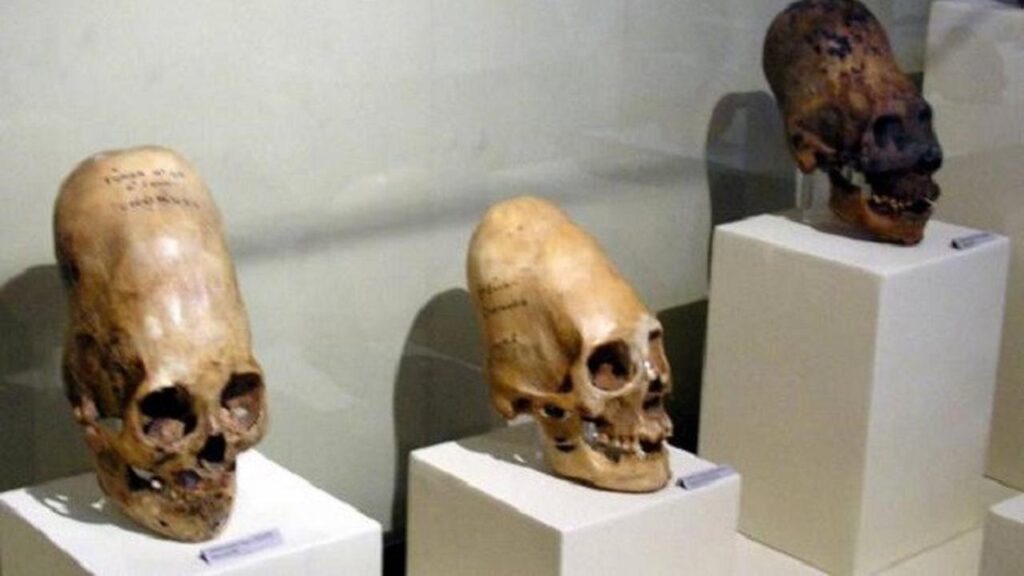 Penemuan Mengejutkan Tengkorak Panjang Mirip Alien Bikin Ilmuwan Bingung