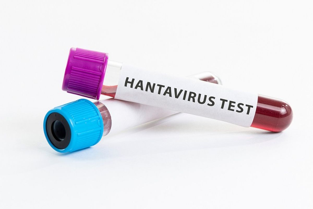 Hantavirus Mengerikan di Kapal Pesiar, 3 Orang Tewas Bikin Dunia Geger Apa yang Terjadi Sebenarnya